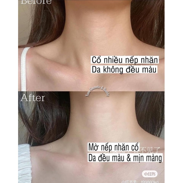 Gold Bond Neck & Chest Firming Cream Kem săn chắc vùng cổ -ngực SALE !! | BigBuy360 - bigbuy360.vn