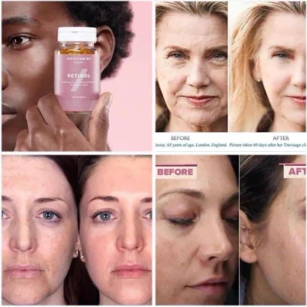 Viên Uống Retinol Myvitamins UK Hộp 90 viên giảm lão hóa giúp đẹp da