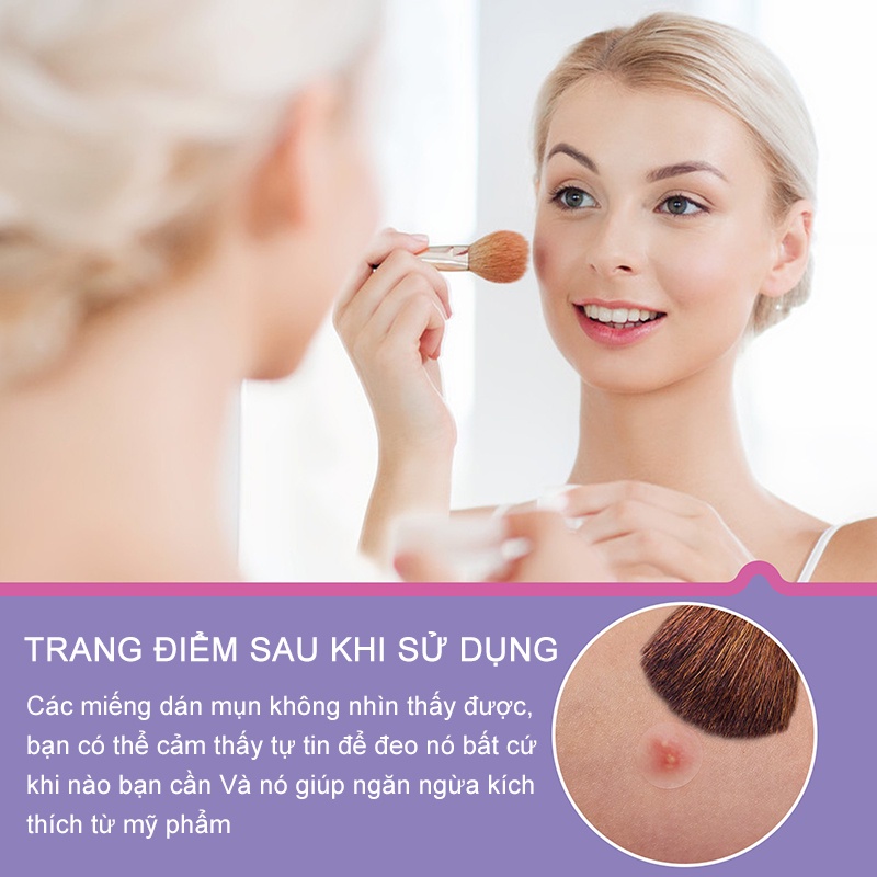 24 miếng dán mụn ẩn, làm sạch và chống viêm (LA-DDT-1)