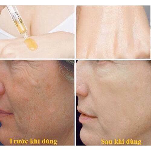 Combo 4 ống tế bào gốc tái tạo, trẻ hóa làn da Coreana Eldas EG tox Program