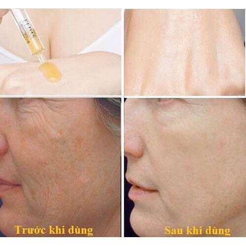 Combo 4 ống tế bào gốc tái tạo, trẻ hóa làn da Coreana Eldas EG tox Program (1 ống x 2ml)