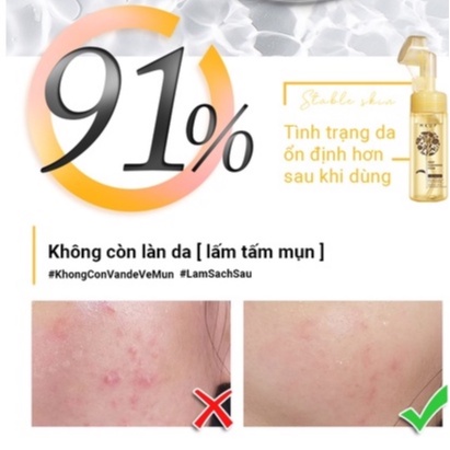 Sữa rửa mặt MKUP  tạo bọt ngăn ngừa mụn, kiểm soát bã nhờn chiết xuất hoa cúc Calendula Extract Sebum Control 150ml | BigBuy360 - bigbuy360.vn