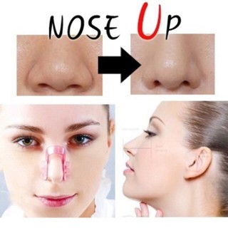 2 Kẹp Nâng Mũi Thon Gọn