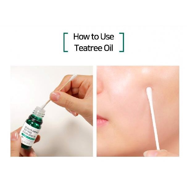 Tinh Dầu Tràm Trà Some By Mi 30 Days Miracle Tea Tree Clear Spot Oil 10ml | BigBuy360 - bigbuy360.vn