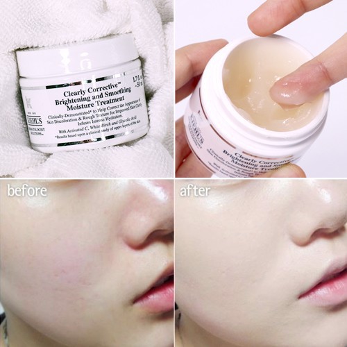 KEM DƯỠNG TRẮNG DA KIEHL.S CLEARLY CORRECTIVE MINI