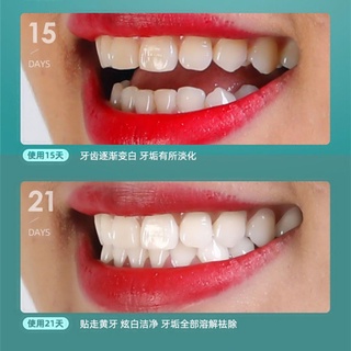 [Hàng mới về] Miếng dán làm trắng răng 5D