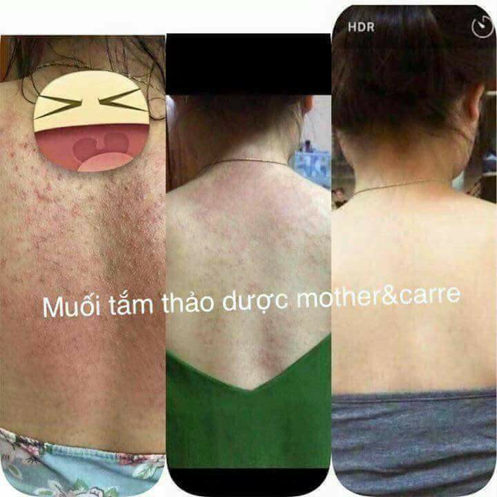 Muối tắm thảo dược Mother & care