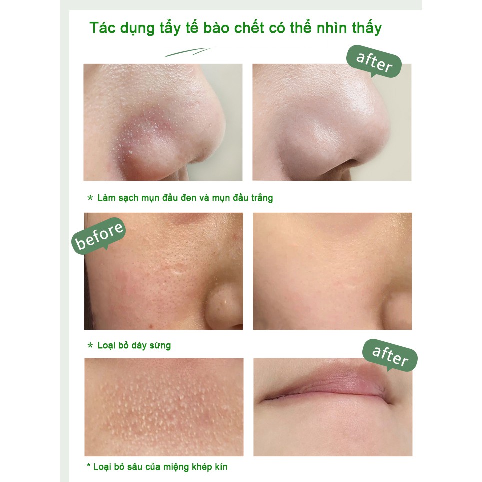 Sữa Tẩy Tế Bào Chết Và Làm Sạch Nhẹ Nhàng RNW / Ruwei 150ml