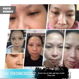 Com bo 5 sét kem Collagen plus vi e