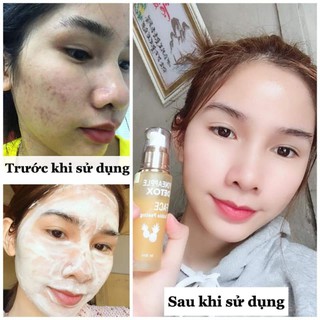 DETOX THẢI ĐỘC DỨA CO2 DÀNH CHO FACE( MẶT)