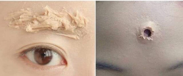 HỘP LỚN nhất- THỊT GIẢ CHE SẸO- ĐỘN MŨI CHUYÊN NGHIỆP - HOÁ TRANG