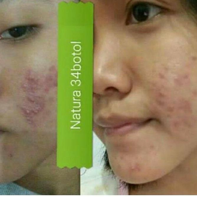 ! Tấm trải giường phun sương làm đẹp mã-288 Natura thế giới 10 | BigBuy360 - bigbuy360.vn