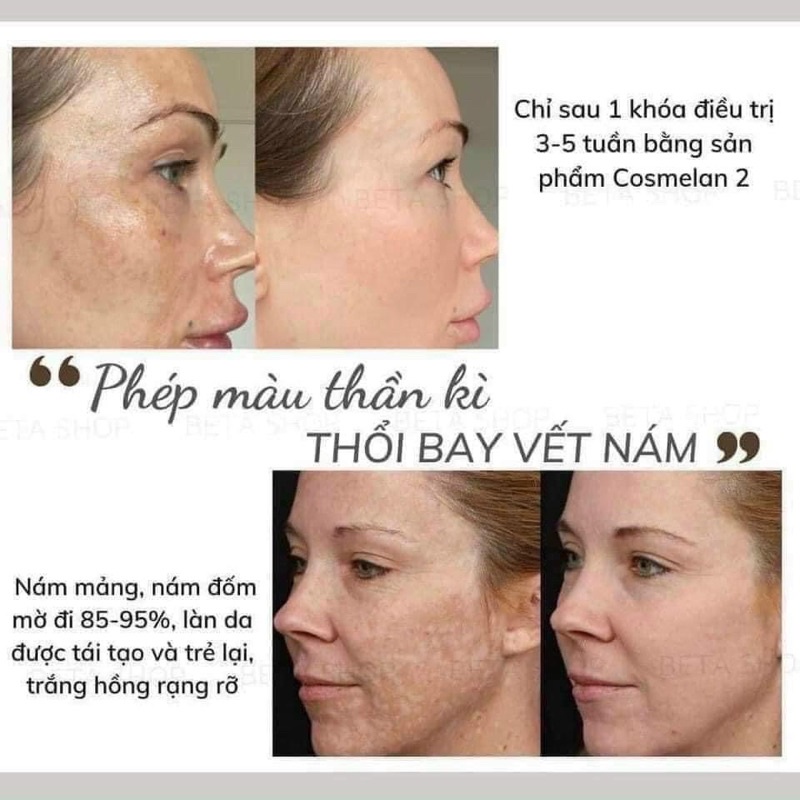 Kem Dưỡng Mờ Nám Tàn Nhang Mesoestetic Cosmelan 2