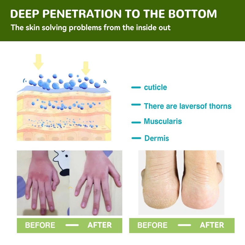 Kem Dưỡng Ẩm Da Tay Và Chân Tẩy Tế Bào Chết Chống Khô Da