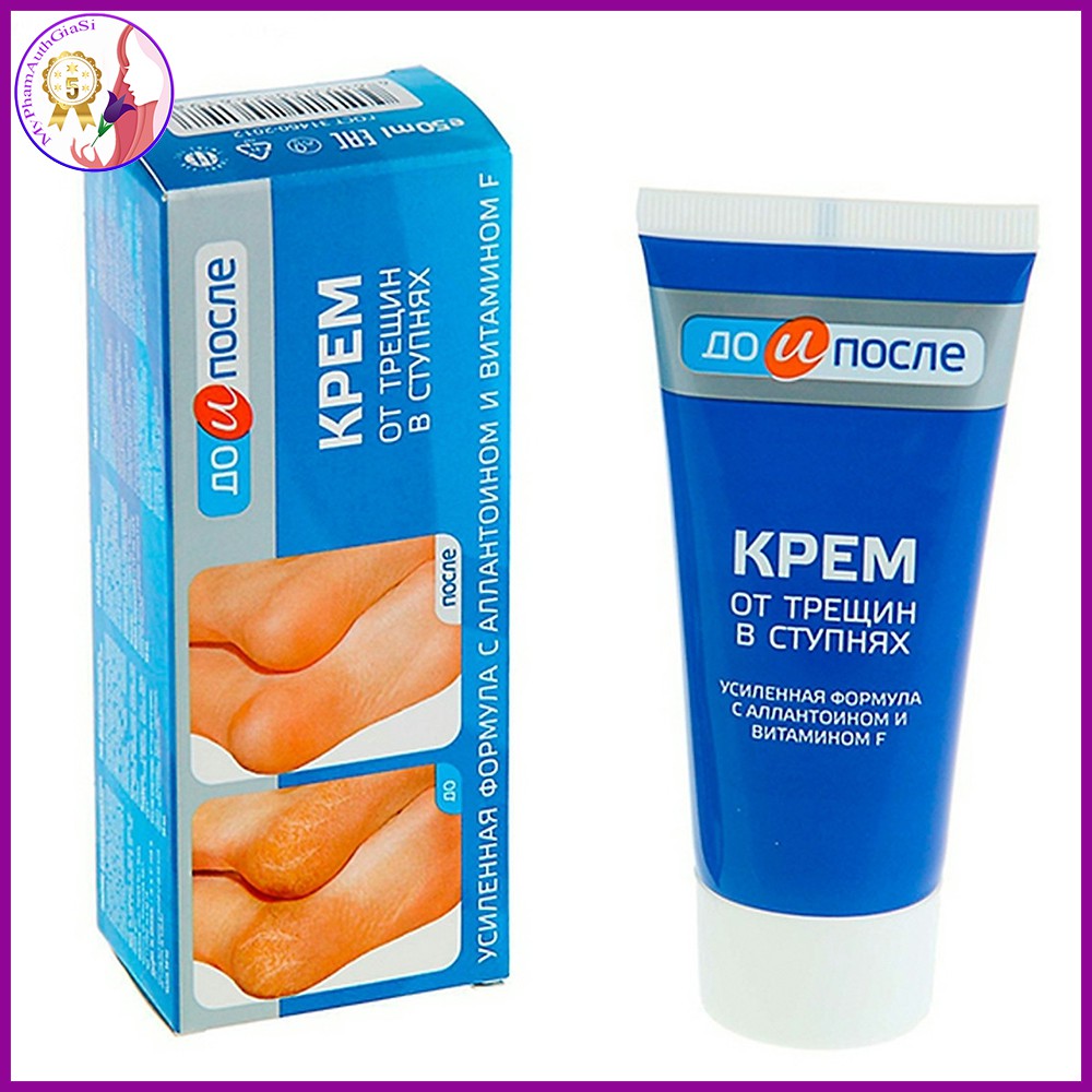 Kem dưỡng da chân Kpem dưỡng ẩm làm mềm và ngăn ngừa nứt gót chân 50ml Nga