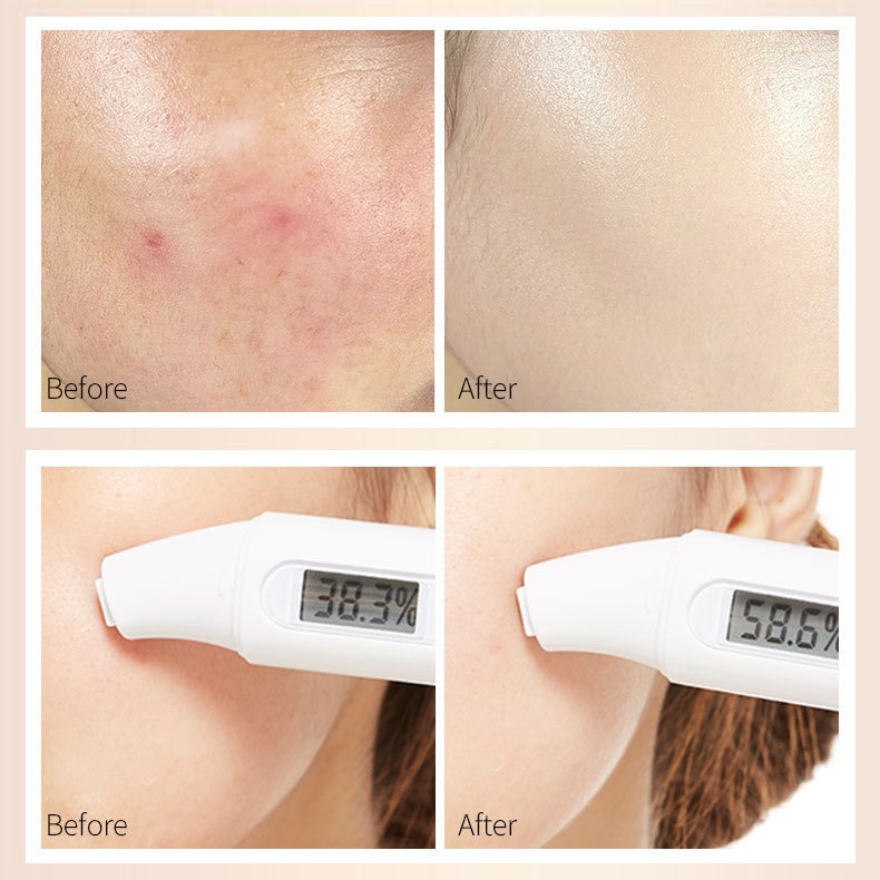 (Sỉ Siêu Rẻ) Kem Nền Trang Điểm Che Khuyết Điểm Dưỡng Ẩm Chống Nước Lameila BB Cream SVMY K26