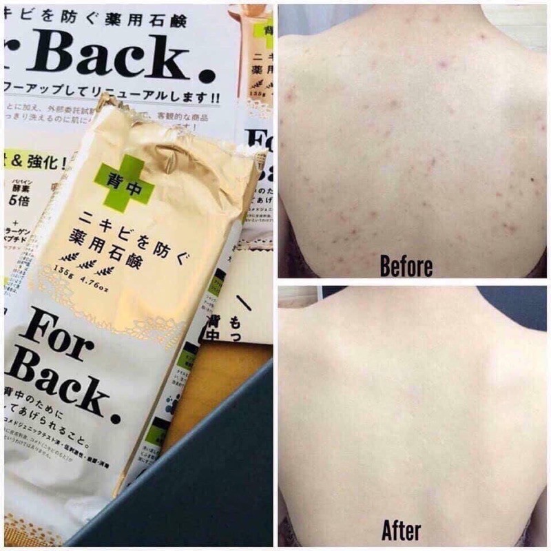 Xà phòng lưng For Back Soap 135g Nhật Bản hiểu quả dùng được 6 tháng
