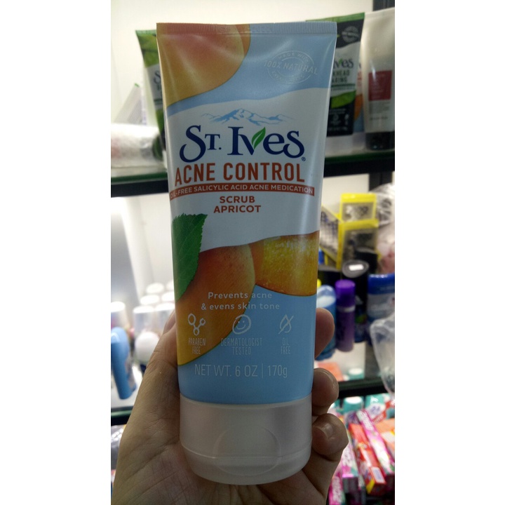 Sữa Rửa Mặt Tẩy Tế Bào Chết St.Ives dành cho da dầu mụn, mụn cám, mụn đầu trắng, đầu đen