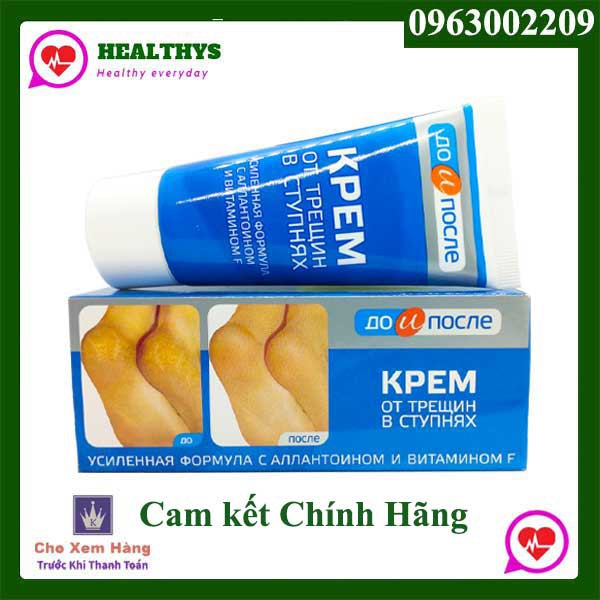 Kem hỗ trợ trị nứt nẻ gót chân KPEM hàng chuẩn nga