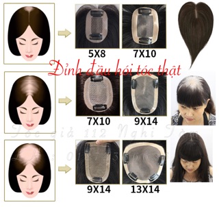 Tóc đỉnh đầu dành cho tóc thưa mỏng