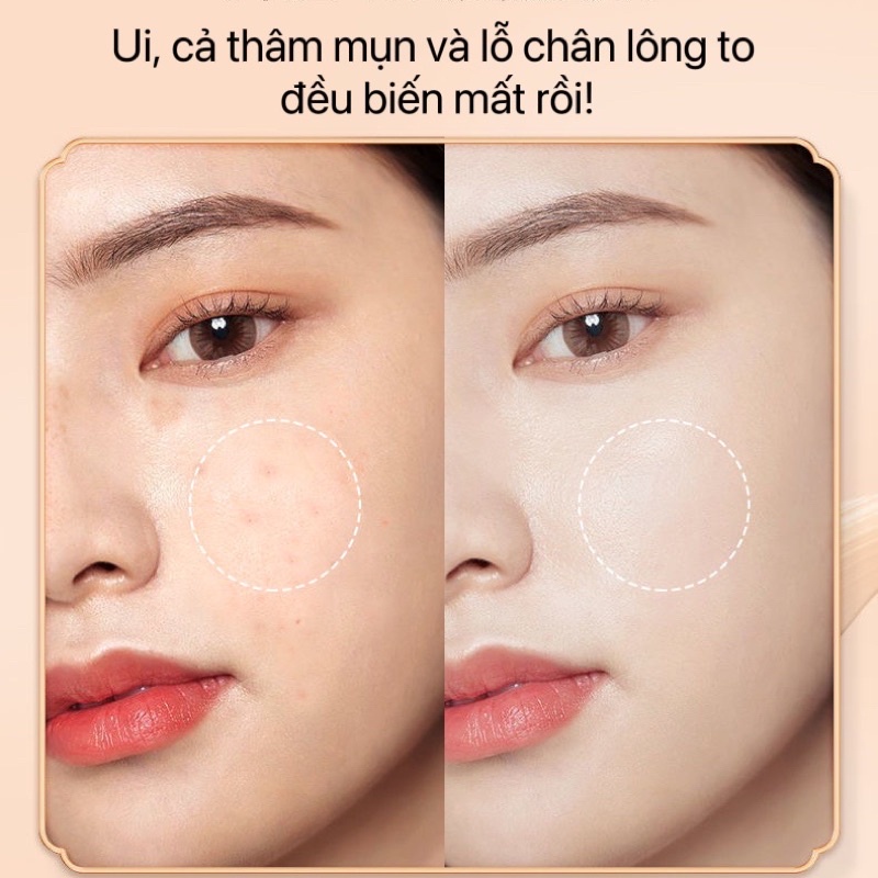 Phấn Nước BB Lameila Che Khuyết Điểm Dưỡng Ẩm Kiểm Soát Dầu Lâu Trôi