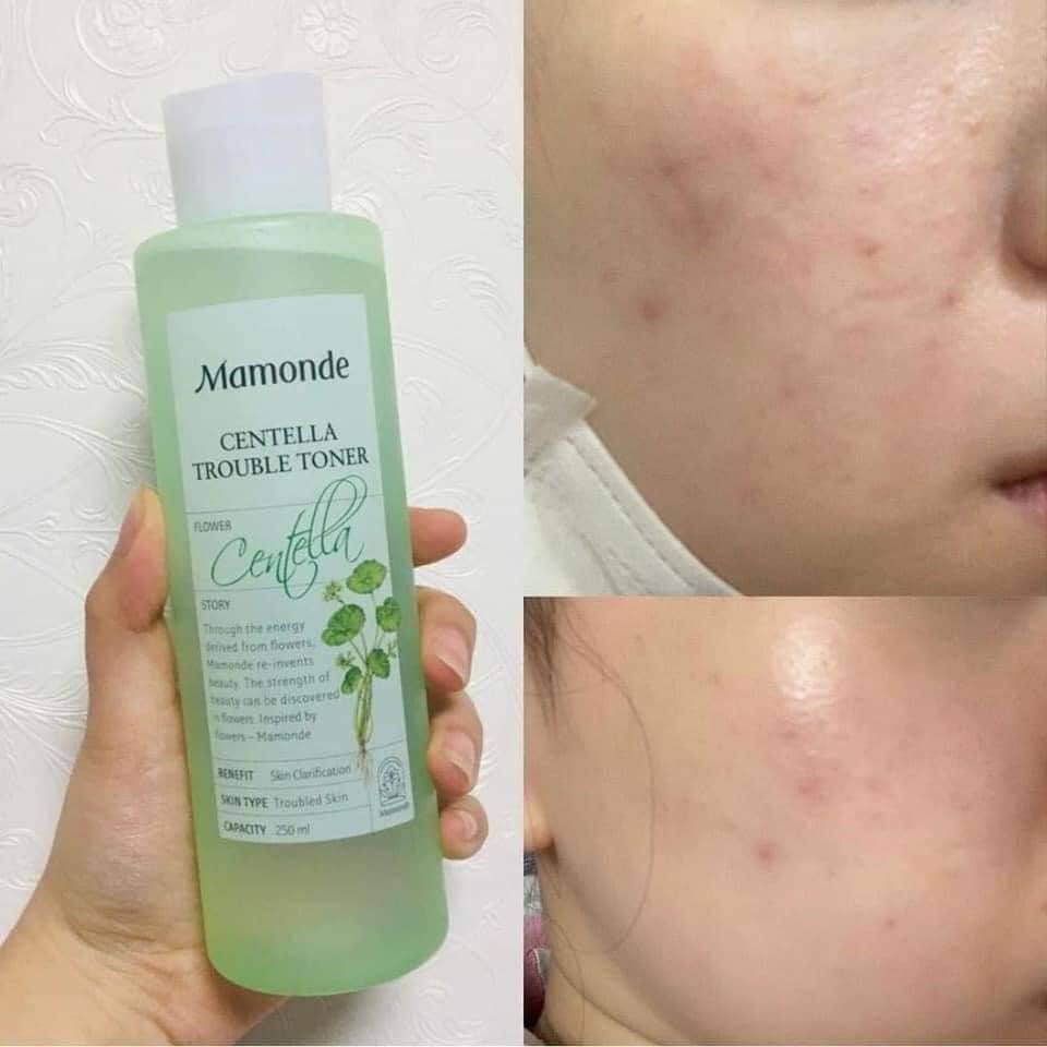 Toner/Nước Hoa Hồng Mamonde Hoa hồng/Rau Má/Diếp Cá