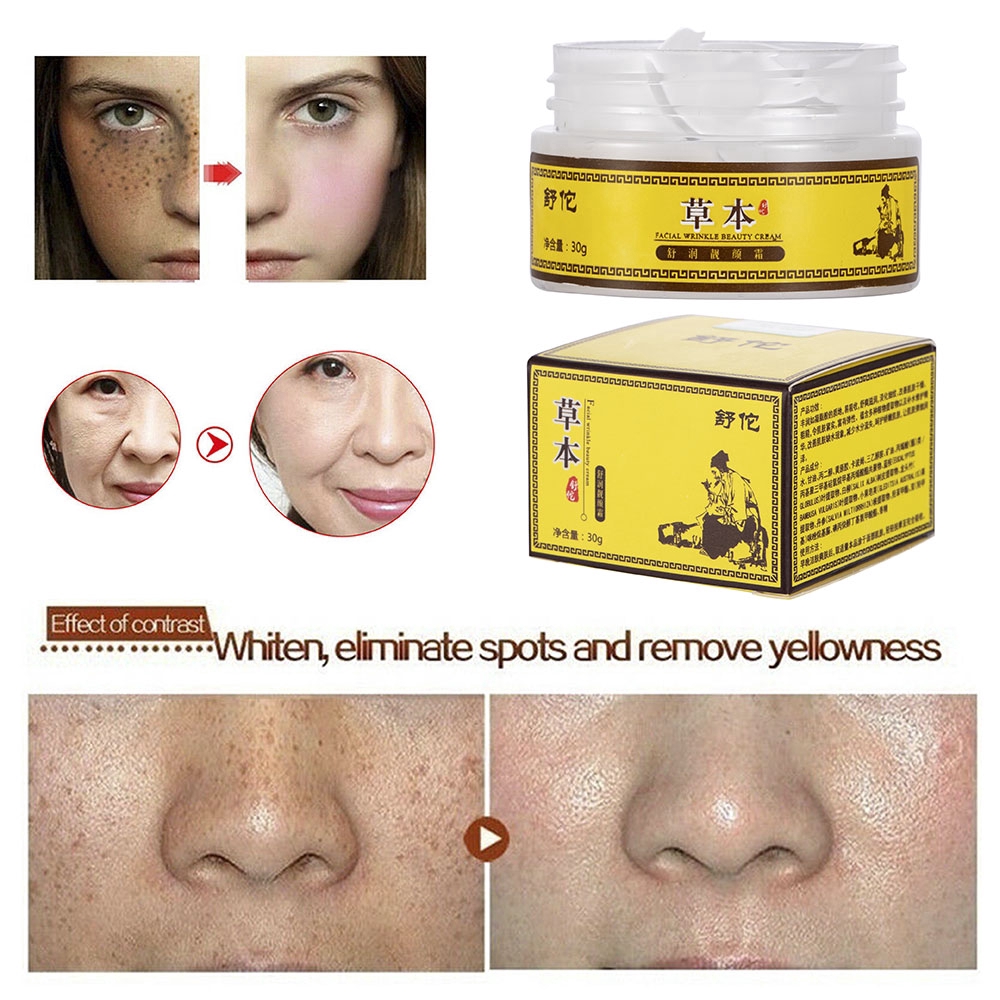 [Hàng mới về] Kem xóa tàn nhang 30g làm trắng phục hồi và chăm sóc da hiệu quả