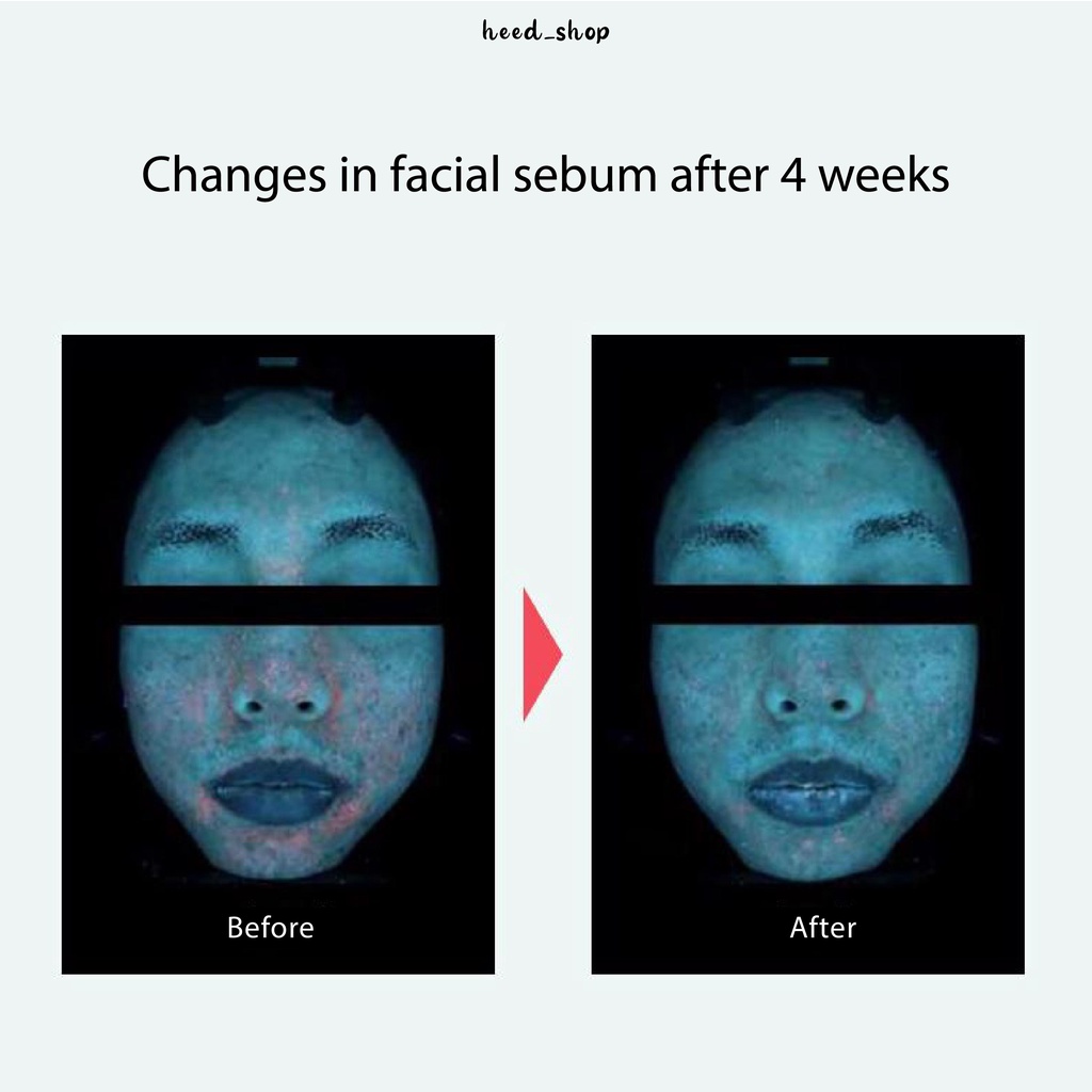 Phấn Nước Chống Nắng 15g  /