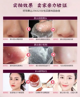 Hàng order❗️Gel đẩy mụn ẩn
