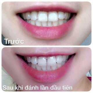 BỘT TRẮNG RĂNG NGA