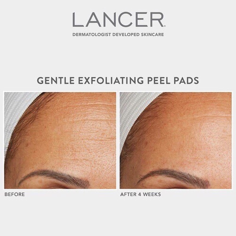 Lancer ✨ Miếng pad tẩy da chết cho da Gentle Exfoliating Peel Pad với 7% Lactic Acid + Bakuchiol