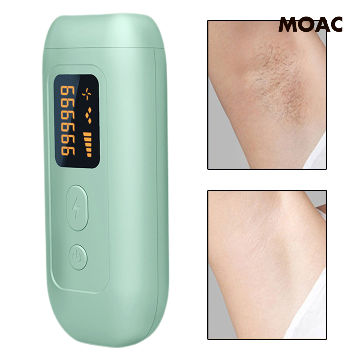 Máy Triệt Lông Bằng Tia Laser Phích Cắm Eu Cho Nam Và Nữ | BigBuy360 - bigbuy360.vn