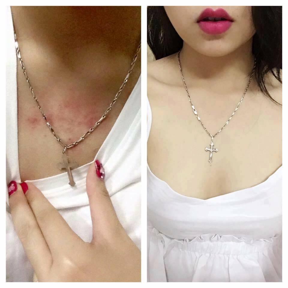 MEN VI SINH TAVIDA CHĂM SÓC LÀN DA VIÊM NANG LÔNG | BigBuy360 - bigbuy360.vn