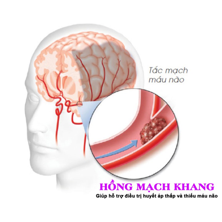 Hồng Mạch Khang - Hỗ trợ bổ máu, tăng tuần hoàn não (Hộp 30 viên)
