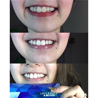 Miếng dán trắng răng Crest 3D Whitening