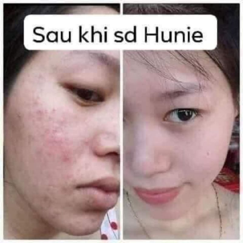 Serum Hunie