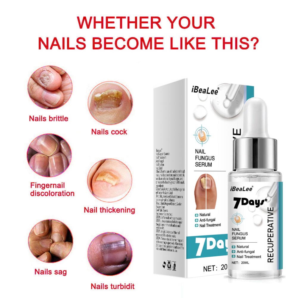 Ibealee Kháng Khuẩn Đặc Biệt Chất Lỏng Cho Onychomycosis Loại Bỏ Móng Kem Làm Dày Mềm Mại Móng Onychomycosis Okase