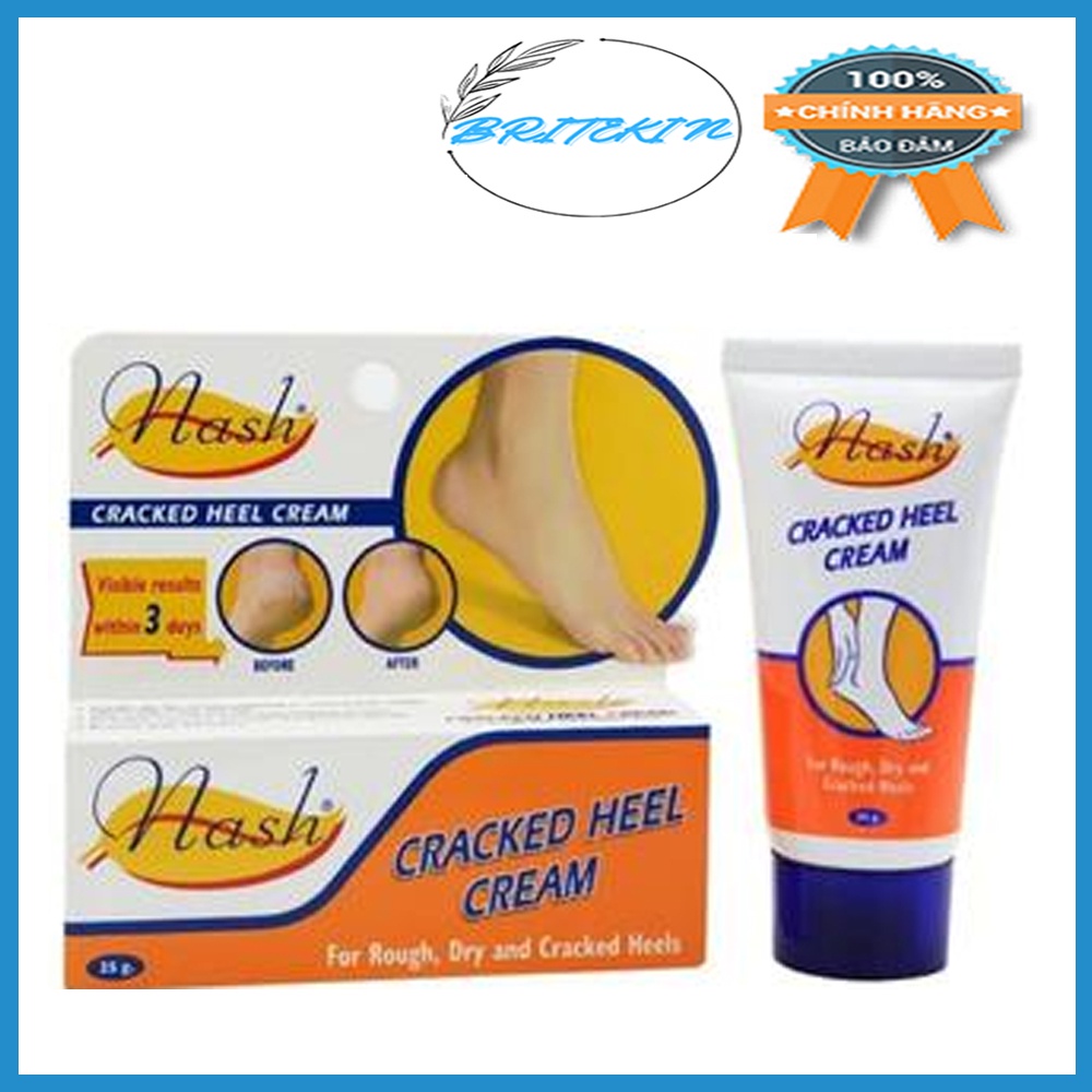 Kem Dưỡng Da Dùng Cho Gót Bàn Chân, Giúp Ngăn Ngừa Nứt Da Gót Chân Nash Cracked Heel Cream 25ml