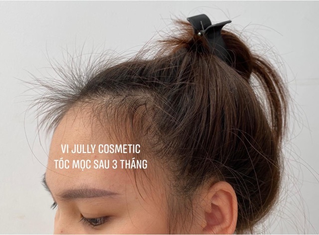 Xịt dưỡng tóc VIJULLY hair lotion