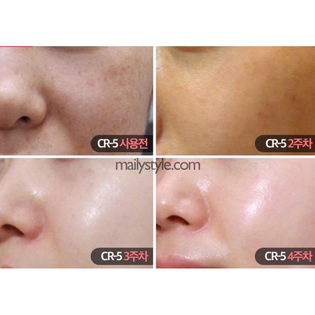 Sample Serum CNPRX cấp nước, dưỡng trắng, thu nhỏ lỗ chân lông căng bóng da Blue Microlift | BigBuy360 - bigbuy360.vn