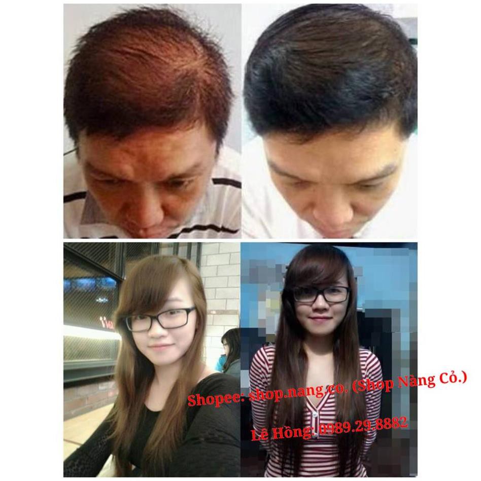 [Chính Hãng] Phân loại Combo Tinh dầu vỏ bưởi, Dầu gội hoa bưởi, Dầu xả dừa, Kích mọc tóc dày dài, Ngăn rụng tóc hói đầu | BigBuy360 - bigbuy360.vn