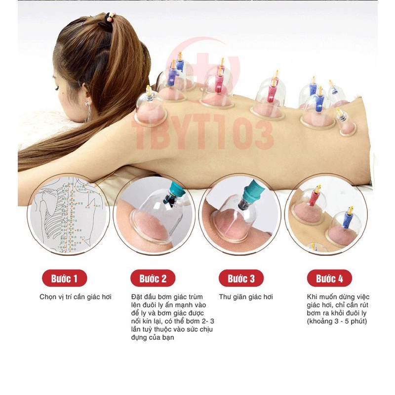 Thiết Bị Giác Hơi Chân Không - Bộ Giác Hơi Không Dùng Lửa 24 Món Cao Cấp, Sử Dụng Nhiều Vị Trí, Thiết Kế Cong HIện Đại