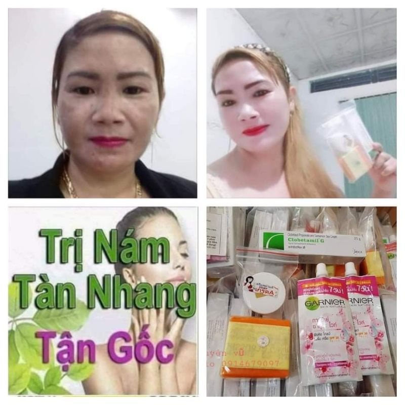 KEM NÁM  CLOBETAMIL G