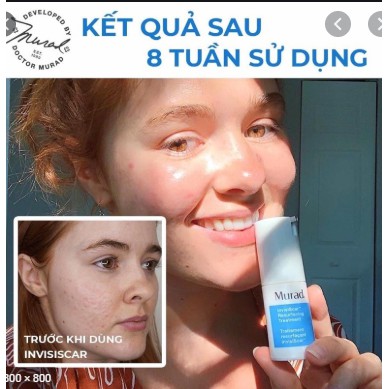 [ Hàng công ty, date xa] Serum làm mờ thâm nám và lấp đầy sẹo rỗ Murad InvisiScar Resurfacing Treatment