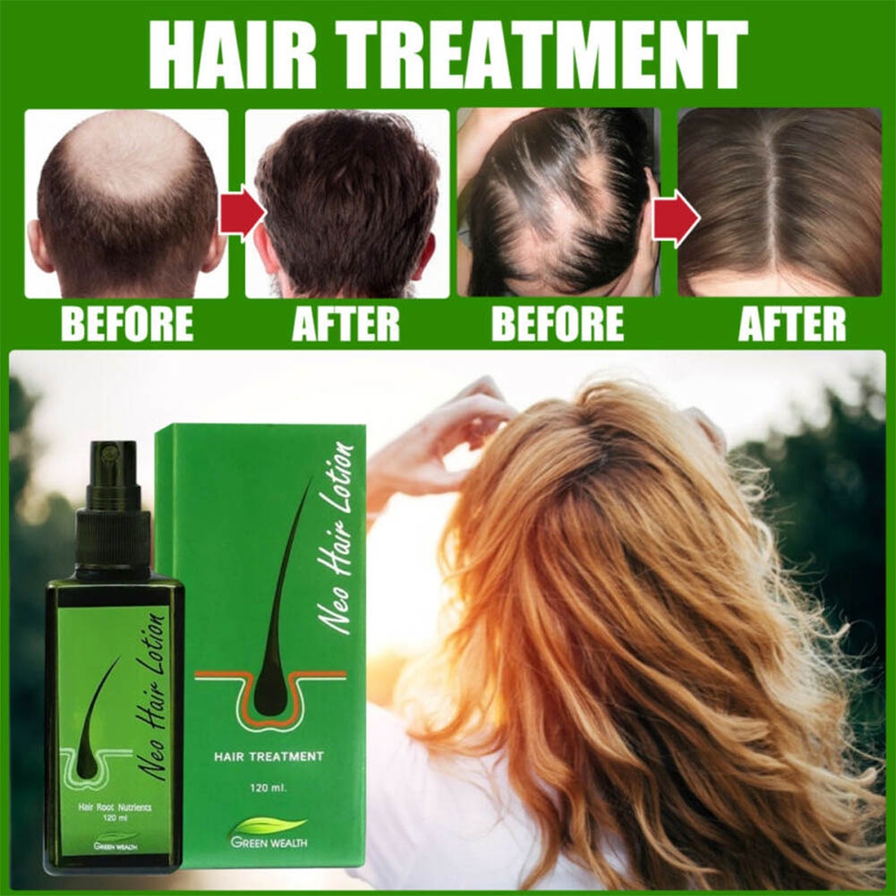 Hair Regrowth Lotion Haircare Hair Loss Oil Baldness Hair thinning 120ml Spray