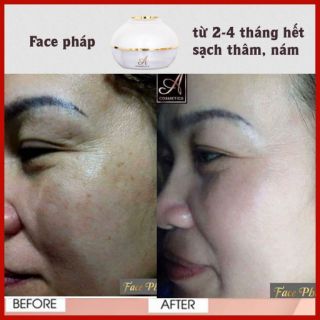 Combo serum kem face pháp mẫu mới