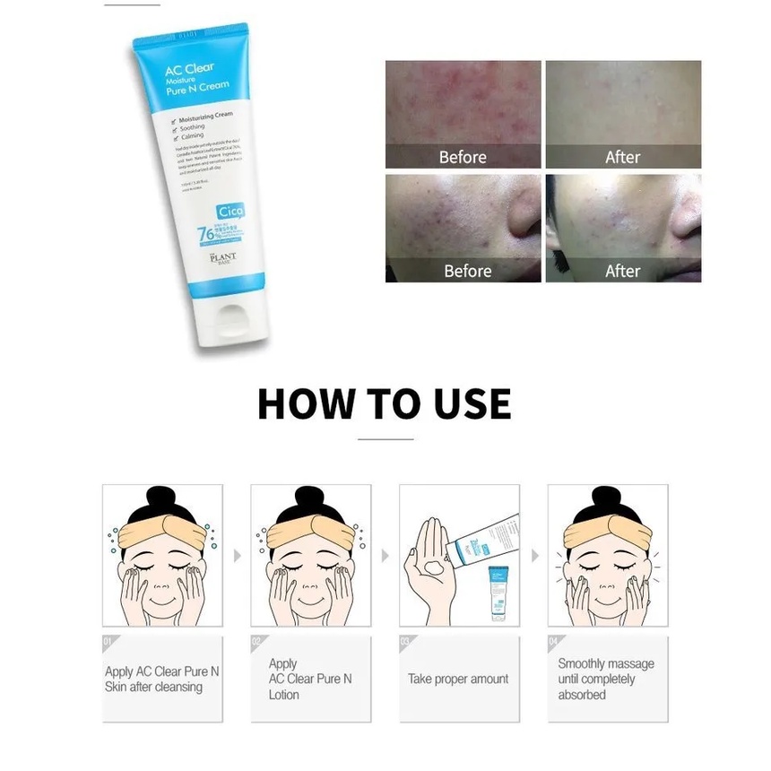 Kem dưỡng ẩm cho da dầu mụn The Plant Base AC Clear Moisture Pure N Cream