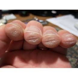 Bao bọc đầu ngón tay khi chơi Guitar