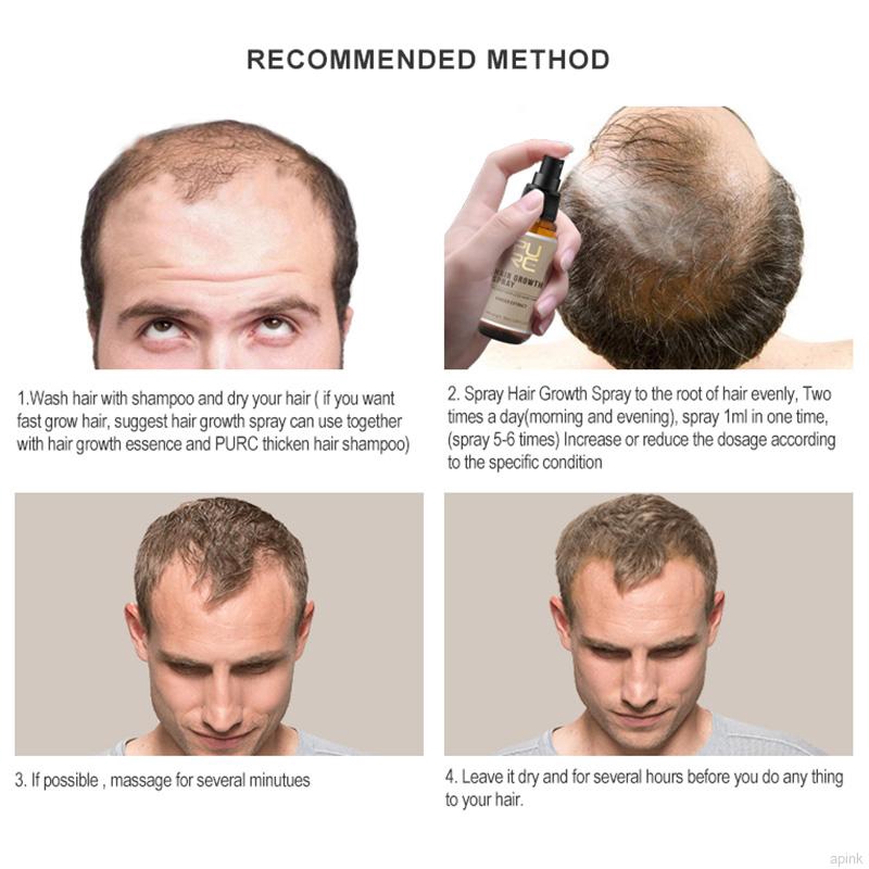 Dầu mọc tóc PURC chống gẫy rụng cao cấp tiện dụng | BigBuy360 - bigbuy360.vn