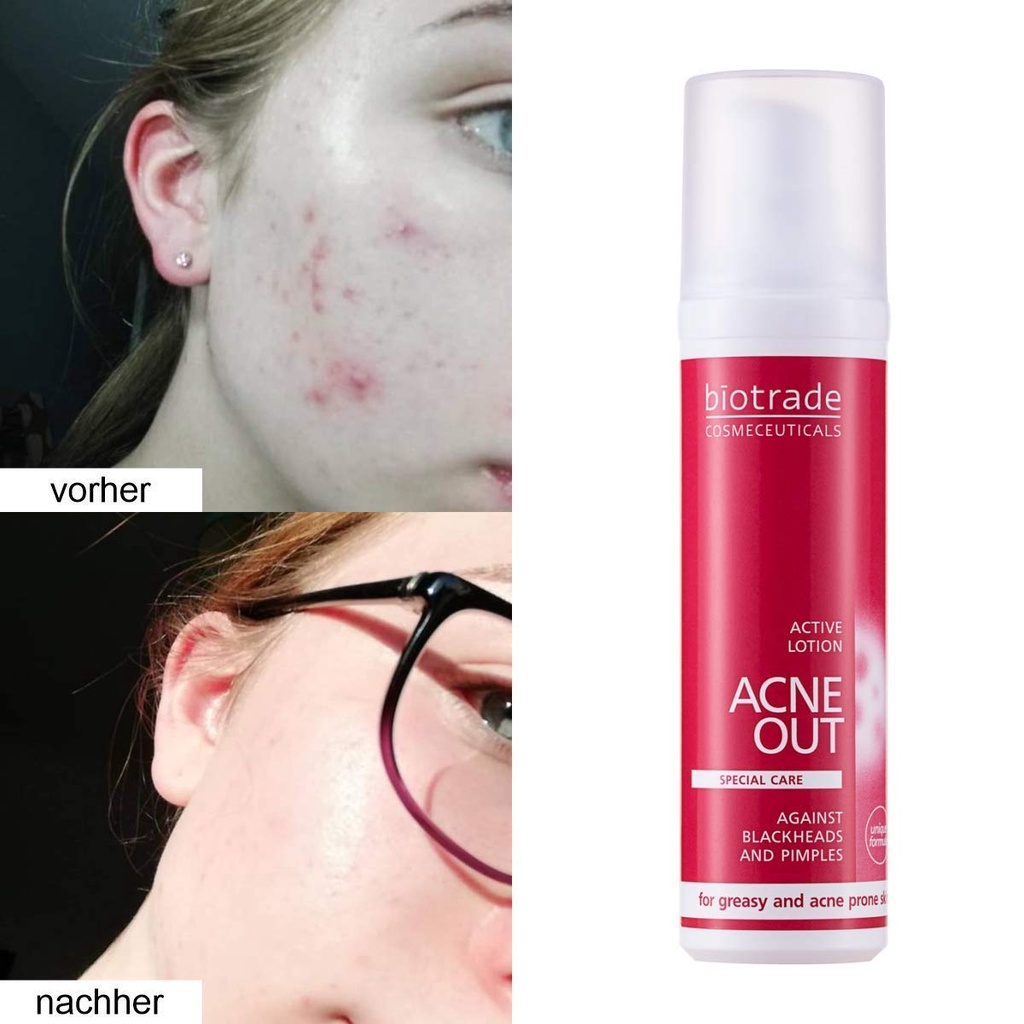 Chấm Mụn Biotrade Acne Out Active Lotion